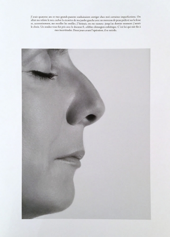 Sophie Calle, Le nez / The plastic surgery, Print 20 x 27 1/2 inches